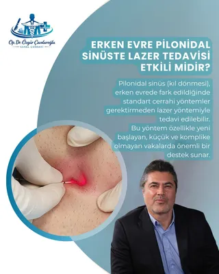 Pilonidal sinüs lazer tedavisi