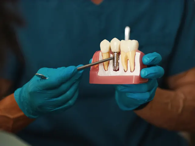 İmplant Tedavisi — Habibler Clinic